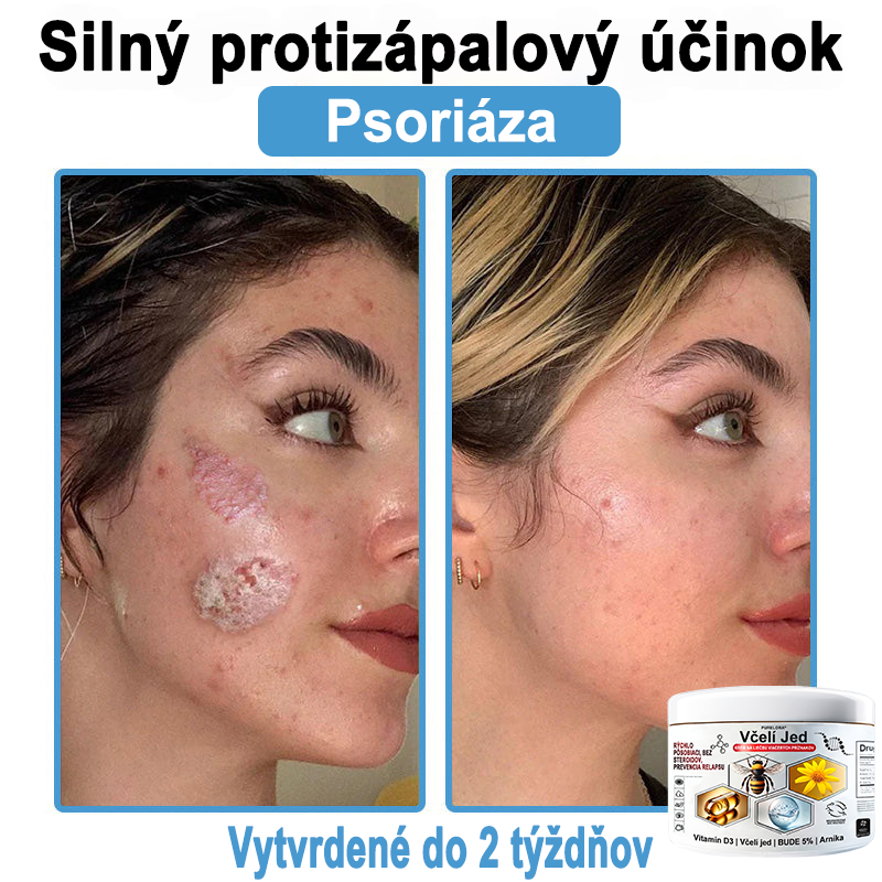 🔥 Dnes až -70% Purelora®⭐ Bee Venom Multi-Symptom Skin Treatment Cream (👨‍⚕𝑶𝒅𝒑𝒐𝒓ú𝒄𝒂 𝑵𝑷𝑭)⚡