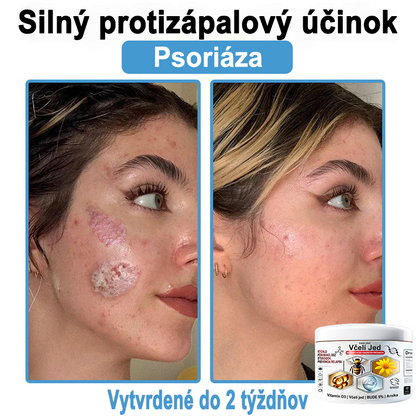 🔥 Dnes až -70% Purelora®⭐ Bee Venom Multi-Symptom Skin Treatment Cream (👨‍⚕𝑶𝒅𝒑𝒐𝒓ú𝒄𝒂 𝑵𝑷𝑭)⚡