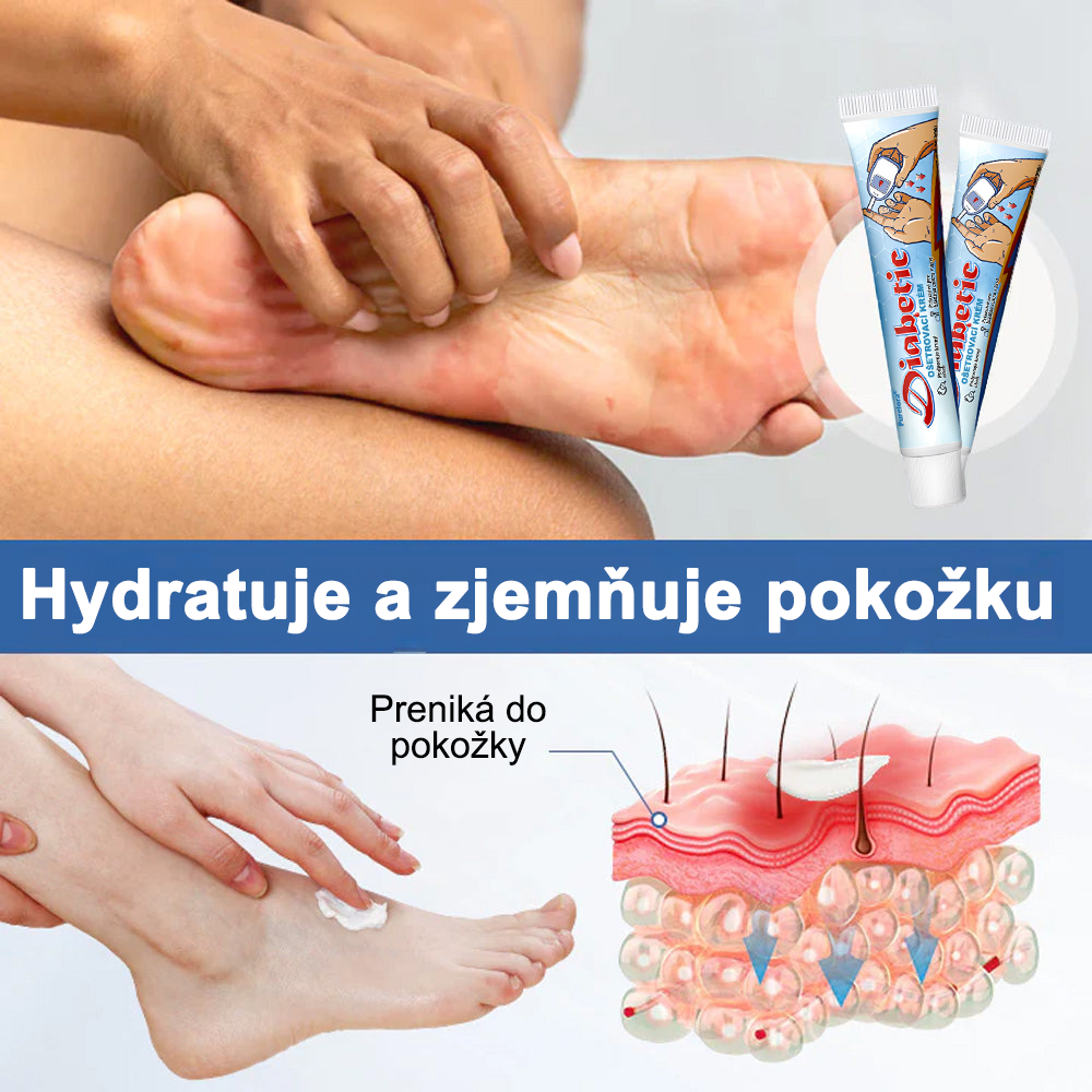 💥 DNES 70 % ZĽAVA – Krém na cukrovku Purelora® VitaGluco