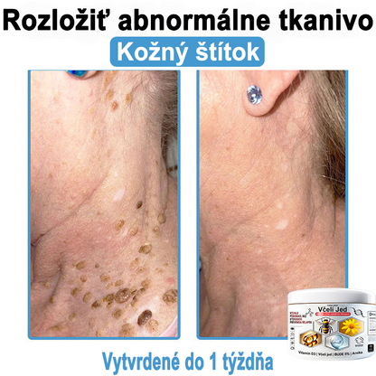 🔥 Dnes až -70% Purelora®⭐ Bee Venom Multi-Symptom Skin Treatment Cream (👨‍⚕𝑶𝒅𝒑𝒐𝒓ú𝒄𝒂 𝑵𝑷𝑭)⚡