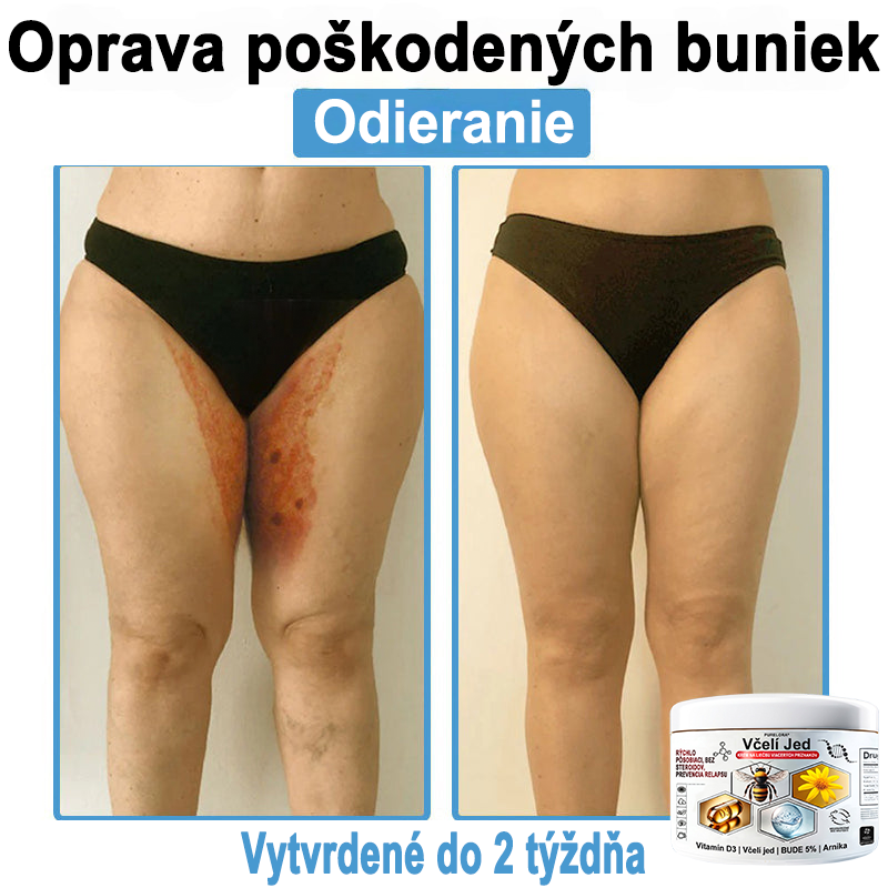 🔥 Dnes až -70% Purelora®⭐ Bee Venom Multi-Symptom Skin Treatment Cream (👨‍⚕𝑶𝒅𝒑𝒐𝒓ú𝒄𝒂 𝑵𝑷𝑭)⚡