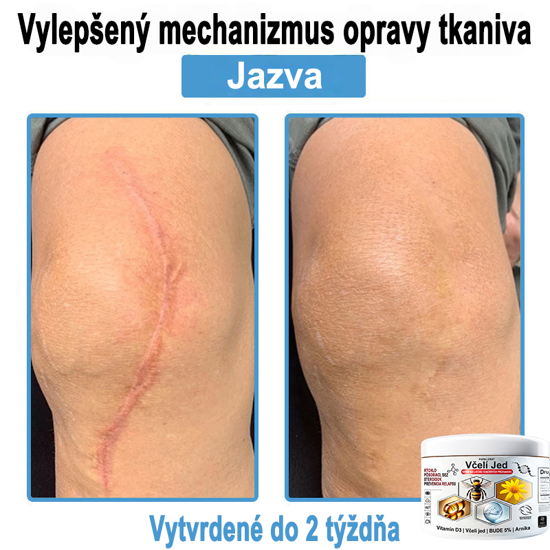 🔥 Dnes až -70% Purelora®⭐ Bee Venom Multi-Symptom Skin Treatment Cream (👨‍⚕𝑶𝒅𝒑𝒐𝒓ú𝒄𝒂 𝑵𝑷𝑭)⚡