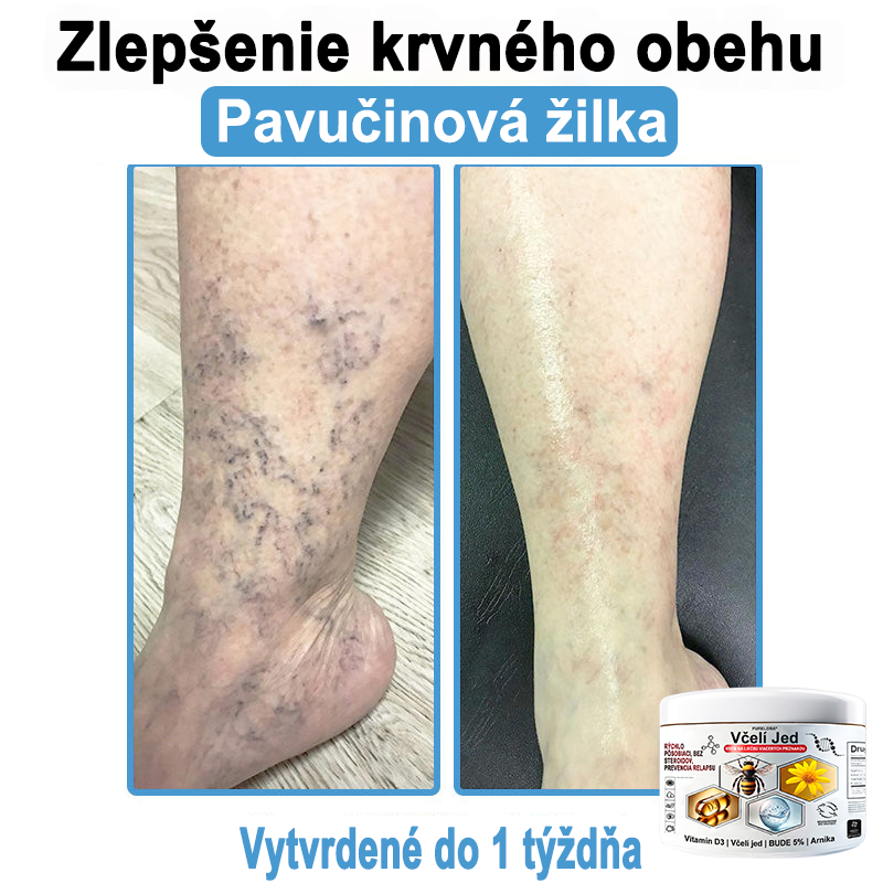 🔥 Dnes až -70% Purelora®⭐ Bee Venom Multi-Symptom Skin Treatment Cream (👨‍⚕𝑶𝒅𝒑𝒐𝒓ú𝒄𝒂 𝑵𝑷𝑭)⚡