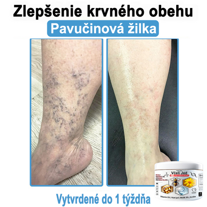 🔥 Dnes až -70% Purelora®⭐ Bee Venom Multi-Symptom Skin Treatment Cream (👨‍⚕𝑶𝒅𝒑𝒐𝒓ú𝒄𝒂 𝑵𝑷𝑭)⚡