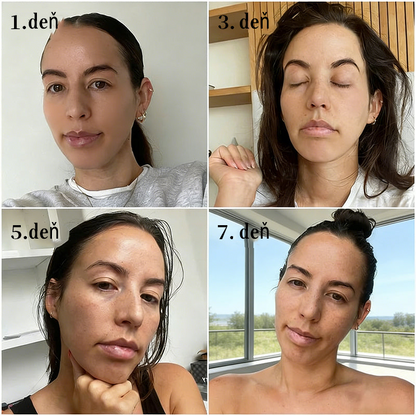 🇸🇰Purelora® Revitalizačný esenciálny krém s kmeňovými💧 bunkovými extraktmi, EGF a meďnatými peptidmi