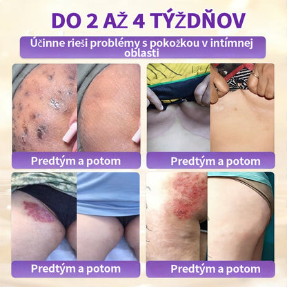 🇸🇰Vyrobené a dodané zo Slovenska ❤ Purelora® Biotínový 10-v-1 krém na obnovu pleti