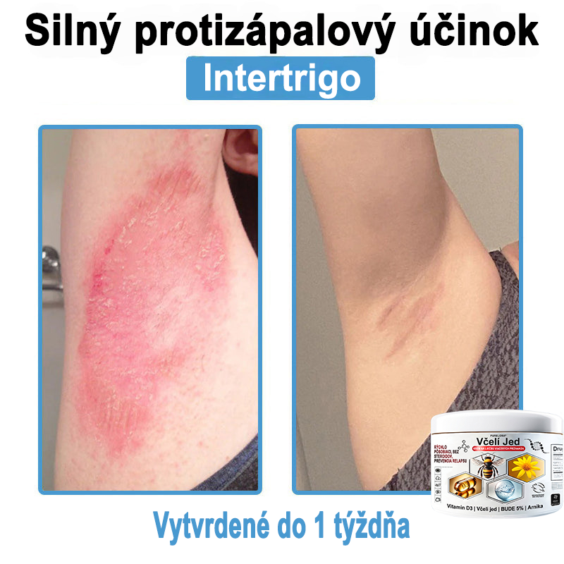 🔥 Dnes až -70% Purelora®⭐ Bee Venom Multi-Symptom Skin Treatment Cream (👨‍⚕𝑶𝒅𝒑𝒐𝒓ú𝒄𝒂 𝑵𝑷𝑭)⚡