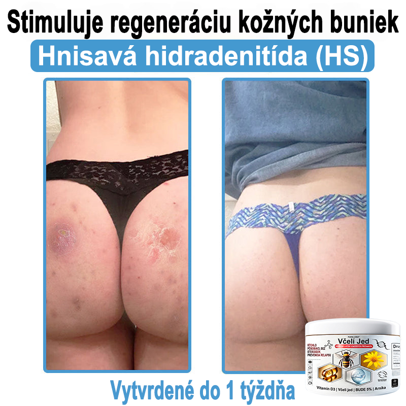 🔥 Dnes až -70% Purelora®⭐ Bee Venom Multi-Symptom Skin Treatment Cream (👨‍⚕𝑶𝒅𝒑𝒐𝒓ú𝒄𝒂 𝑵𝑷𝑭)⚡