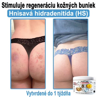 🔥 Dnes až -70% Purelora®⭐ Bee Venom Multi-Symptom Skin Treatment Cream (👨‍⚕𝑶𝒅𝒑𝒐𝒓ú𝒄𝒂 𝑵𝑷𝑭)⚡