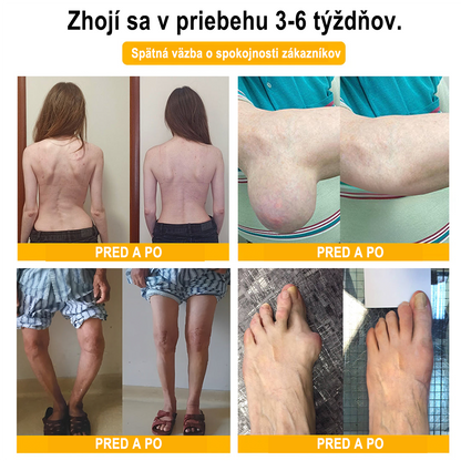 🇸🇰Purelora® krém na hojenie kostí s botulotoxínom🐝a včelím jedom, ktorý zmierňuje bolesť🌿 (špeciálne pre starších ľudí a odporúčaný ortopedickými špecialistami)🔥