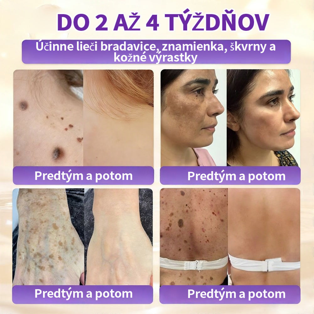 🇸🇰Vyrobené a dodané zo Slovenska ❤ Purelora® Biotínový 10-v-1 krém na obnovu pleti