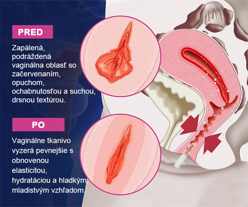 📢Curalona® Okamžitý zastavovač svrbenia a detoxikácia, zoštíhľujúci a spevňujúci regeneračný krém a ružové a jemné prírodné kapsuly PRO