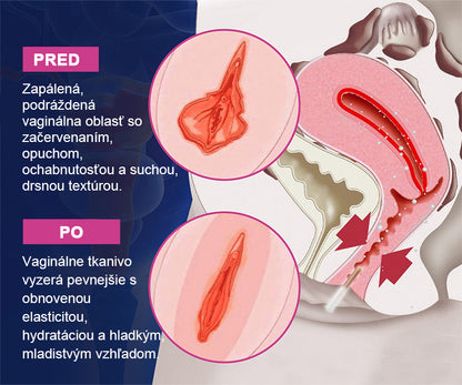 📢Curalona® Okamžitý zastavovač svrbenia a detoxikácia, zoštíhľujúci a spevňujúci regeneračný krém a ružové a jemné prírodné kapsuly PRO