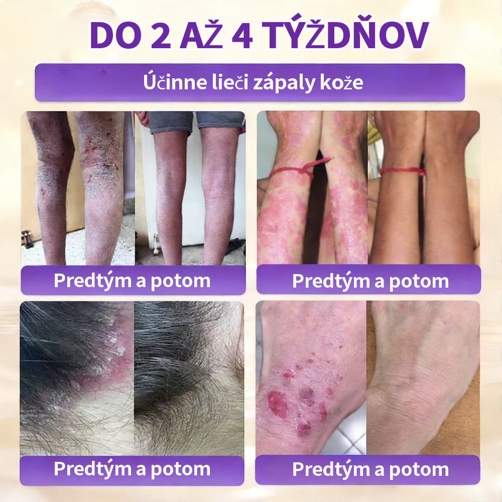 🇸🇰Vyrobené a dodané zo Slovenska ❤ Purelora® Biotínový 10-v-1 krém na obnovu pleti