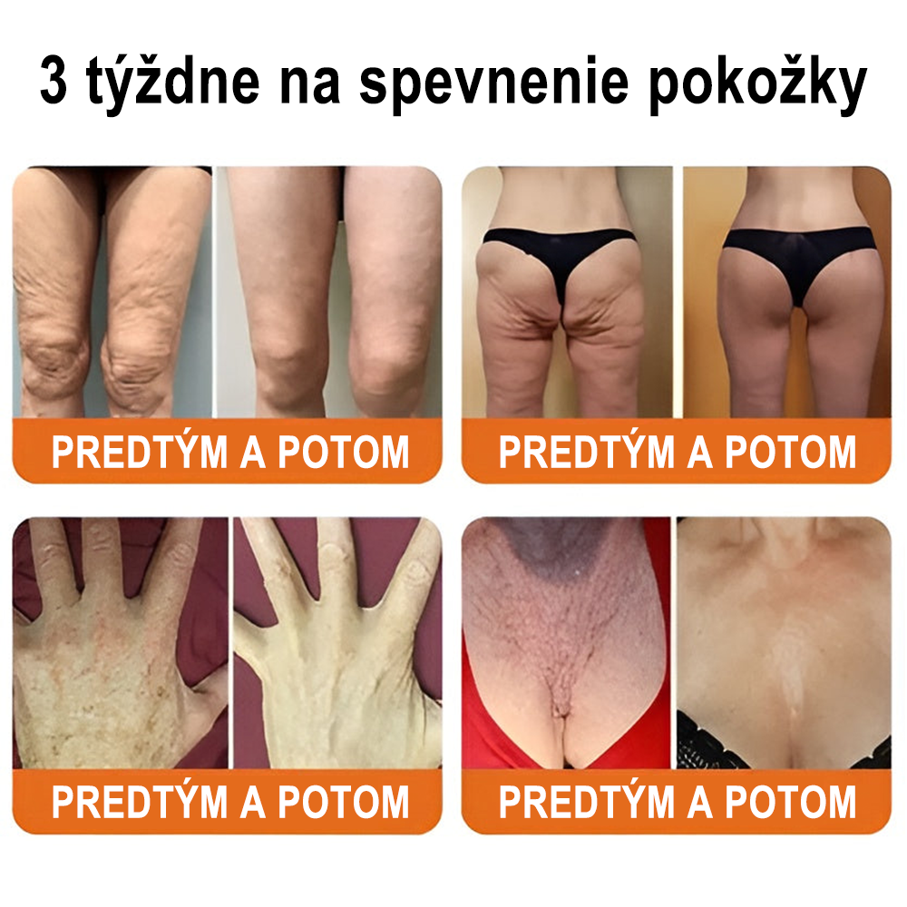 ✨ ZödVita® Krém na obnovu pokožky s včelím jedom 🔥 Prírodný anti-aging účinok, spevňuje pokožku, redukuje vrásky – 50 ml