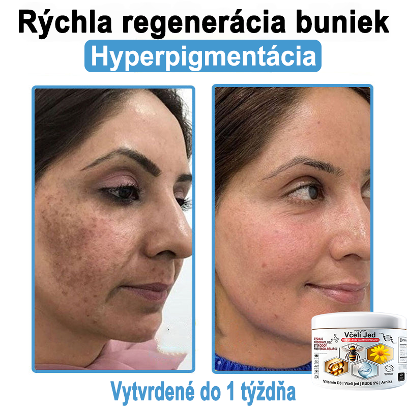 🔥 Dnes až -70% Purelora®⭐ Bee Venom Multi-Symptom Skin Treatment Cream (👨‍⚕𝑶𝒅𝒑𝒐𝒓ú𝒄𝒂 𝑵𝑷𝑭)⚡