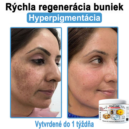 🔥 Dnes až -70% Purelora®⭐ Bee Venom Multi-Symptom Skin Treatment Cream (👨‍⚕𝑶𝒅𝒑𝒐𝒓ú𝒄𝒂 𝑵𝑷𝑭)⚡