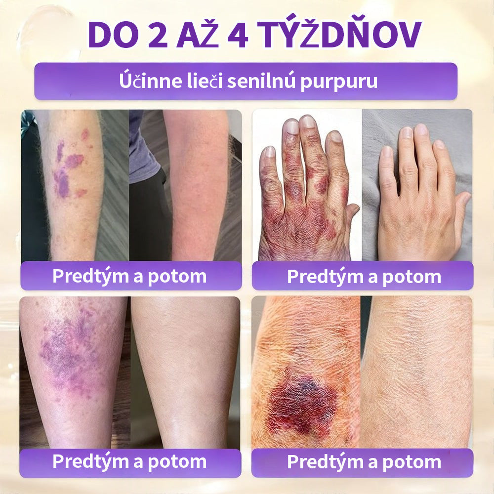 🇸🇰Vyrobené a dodané zo Slovenska ❤ Purelora® Biotínový 10-v-1 krém na obnovu pleti