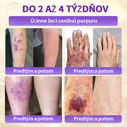 🇸🇰Vyrobené a dodané zo Slovenska ❤ Purelora® Biotínový 10-v-1 krém na obnovu pleti