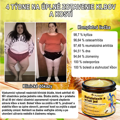 🇸🇰Purelora® krém na hojenie kostí s botulotoxínom🐝a včelím jedom, ktorý zmierňuje bolesť🌿 (špeciálne pre starších ľudí a odporúčaný ortopedickými špecialistami)🔥