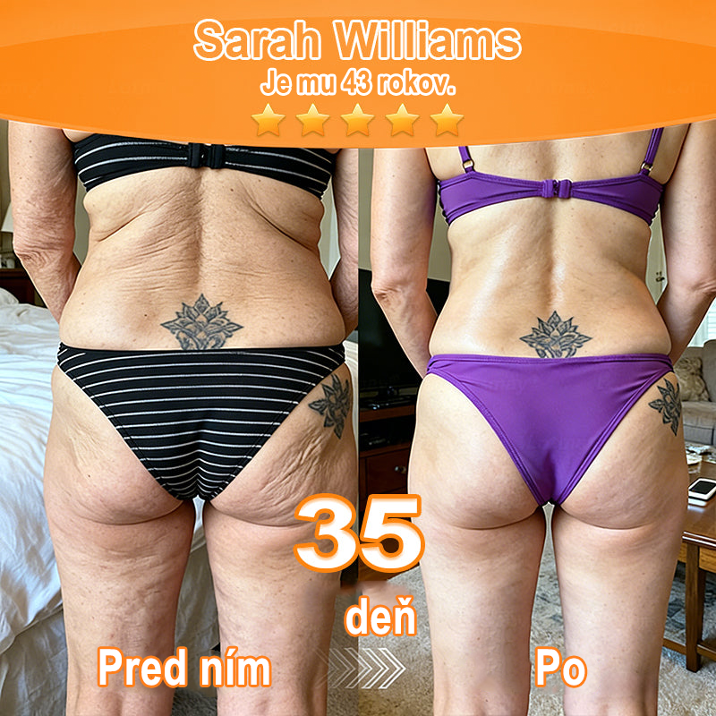 🇸🇰Purelora® Revitalizačný esenciálny krém s kmeňovými💧 bunkovými extraktmi, EGF a meďnatými peptidmi