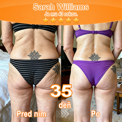 🇸🇰Purelora® Revitalizačný esenciálny krém s kmeňovými💧 bunkovými extraktmi, EGF a meďnatými peptidmi