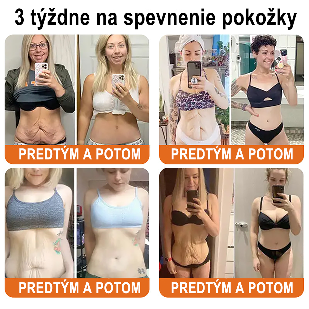 ✨ ZödVita® Krém na obnovu pokožky s včelím jedom 🔥 Prírodný anti-aging účinok, spevňuje pokožku, redukuje vrásky – 50 ml