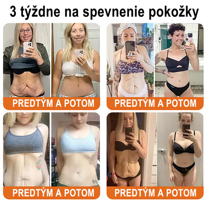 ✨ ZödVita® Krém na obnovu pokožky s včelím jedom 🔥 Prírodný anti-aging účinok, spevňuje pokožku, redukuje vrásky – 50 ml