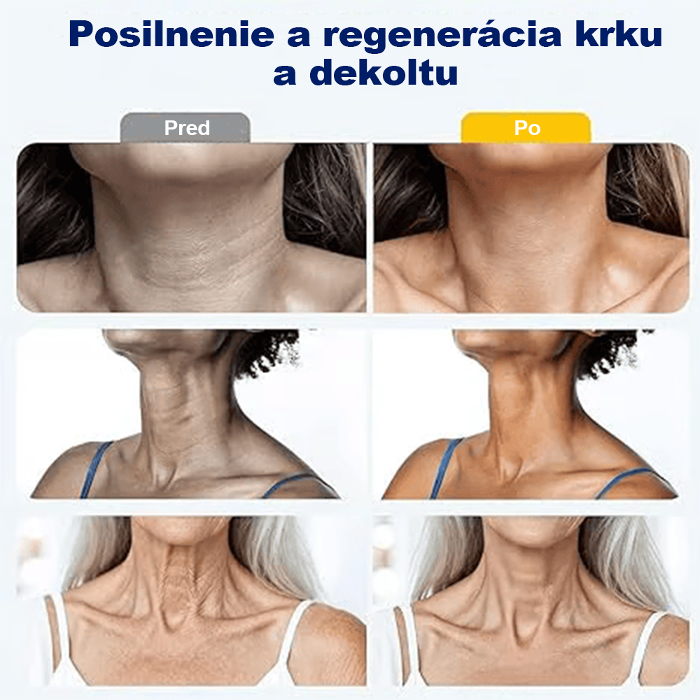 🍀 Purelora® Instantný krém na lifting krku — 🎁 Obohatený o retinol a kyselinu hyalurónovú | Pomáha spevniť pokožku krku, redukovať vrásky a zlepšiť vzhľad dvojitej brady
