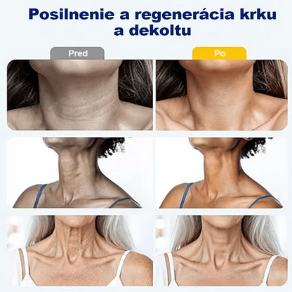 🍀 Purelora® Instantný krém na lifting krku — 🎁 Obohatený o retinol a kyselinu hyalurónovú | Pomáha spevniť pokožku krku, redukovať vrásky a zlepšiť vzhľad dvojitej brady