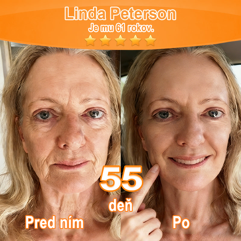 🇸🇰Purelora® Revitalizačný esenciálny krém s kmeňovými💧 bunkovými extraktmi, EGF a meďnatými peptidmi