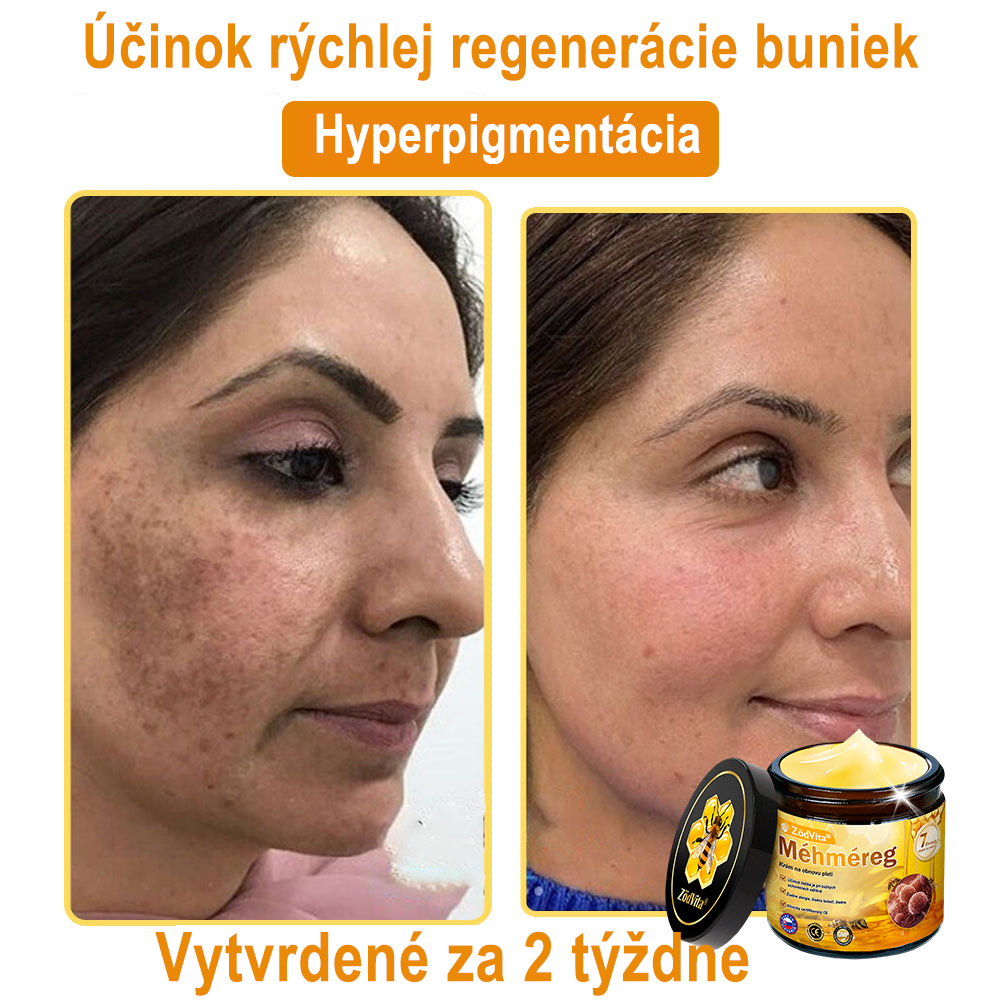 ✨ ZödVita® Krém na obnovu pokožky s včelím jedom 🔥 Prírodný anti-aging účinok, spevňuje pokožku, redukuje vrásky – 50 ml