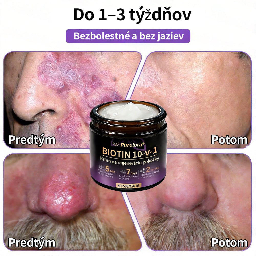 🇸🇰Vyrobené a dodané zo Slovenska ❤ Purelora® Biotínový 10-v-1 krém na obnovu pleti