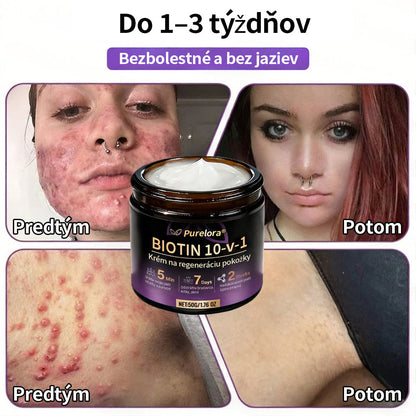 🇸🇰Vyrobené a dodané zo Slovenska ❤ Purelora® Biotínový 10-v-1 krém na obnovu pleti