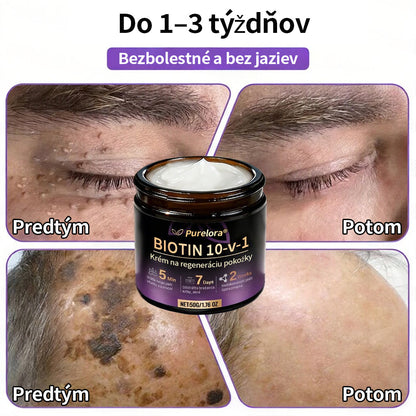 🇸🇰Vyrobené a dodané zo Slovenska ❤ Purelora® Biotínový 10-v-1 krém na obnovu pleti