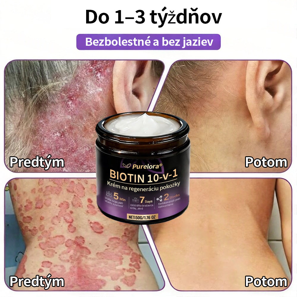 🇸🇰Vyrobené a dodané zo Slovenska ❤ Purelora® Biotínový 10-v-1 krém na obnovu pleti