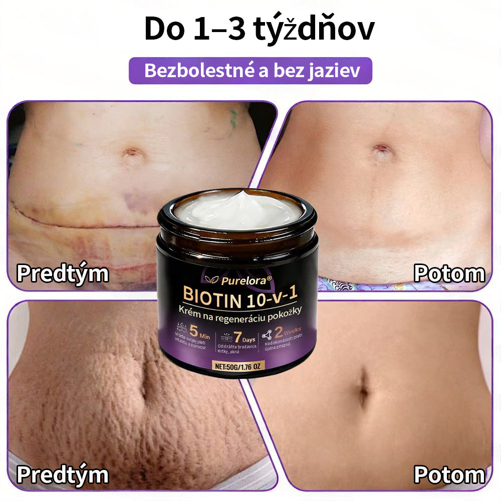 🇸🇰Vyrobené a dodané zo Slovenska ❤ Purelora® Biotínový 10-v-1 krém na obnovu pleti