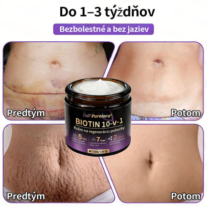 🇸🇰Vyrobené a dodané zo Slovenska ❤ Purelora® Biotínový 10-v-1 krém na obnovu pleti