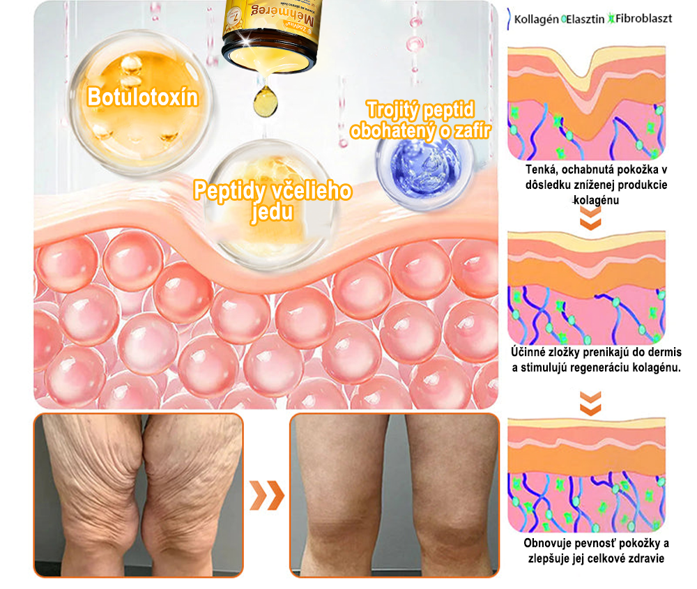 ✨ ZödVita® Krém na obnovu pokožky s včelím jedom 🔥 Prírodný anti-aging účinok, spevňuje pokožku, redukuje vrásky – 50 ml