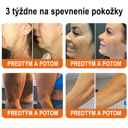 ✨ ZödVita® Krém na obnovu pokožky s včelím jedom 🔥 Prírodný anti-aging účinok, spevňuje pokožku, redukuje vrásky – 50 ml