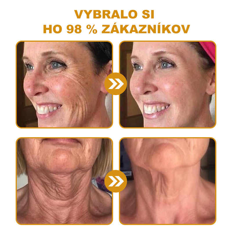 🇸🇰Posledný deň výpredaja: 70% zľava - Purelora®💃 Botox krém proti vráskam s včelím jedom