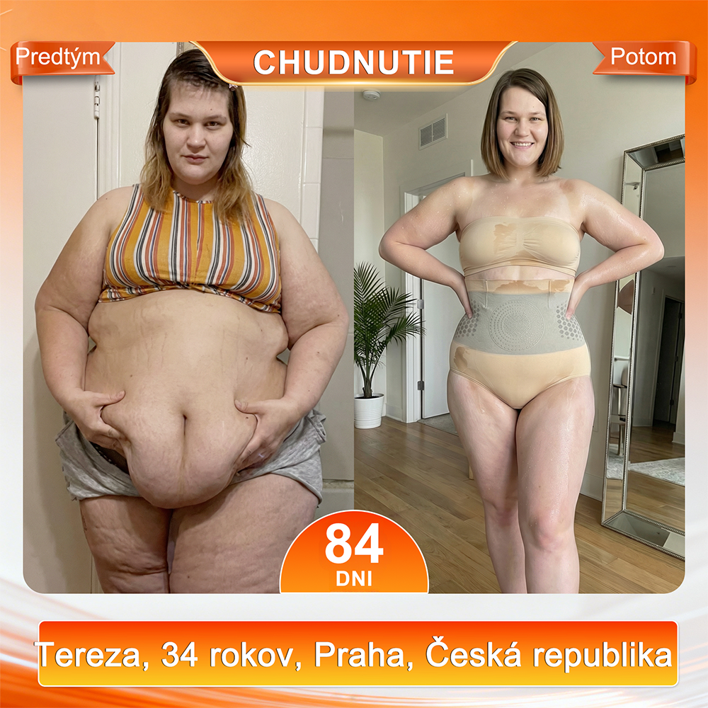 ☘️Sfrcord® 4v1 Termogénne Tvarujúce Šortky s Moringou a Berberin  – 🍁 Kompresné Kraťasy pre Tvarovanie Postavy, Podporu Metabolizmu & Denné Nosenie (30 min rutina) 🌸 Časovo obmedzená zľava až 7