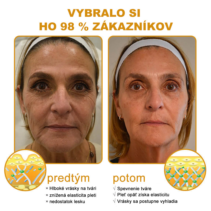 🇸🇰Posledný deň výpredaja: 70% zľava - Purelora®💃 Botox krém proti vráskam s včelím jedom