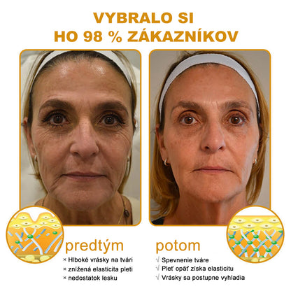 🇸🇰Posledný deň výpredaja: 70% zľava - Purelora®💃 Botox krém proti vráskam s včelím jedom