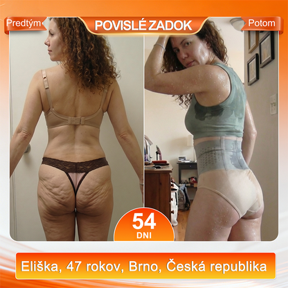 ☘️Sfrcord® 4v1 Termogénne Tvarujúce Šortky s Moringou a Berberin  – 🍁 Kompresné Kraťasy pre Tvarovanie Postavy, Podporu Metabolizmu & Denné Nosenie (30 min rutina) 🌸 Časovo obmedzená zľava až 7