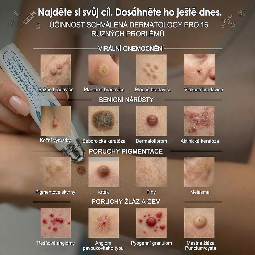 Oficiálny obchod značky |🔥Purelora® 7-dňový odstraňovač kožných výrastkov a škvŕn (bez bolesti, bez jaziev – rollerball aplikátor)🌈