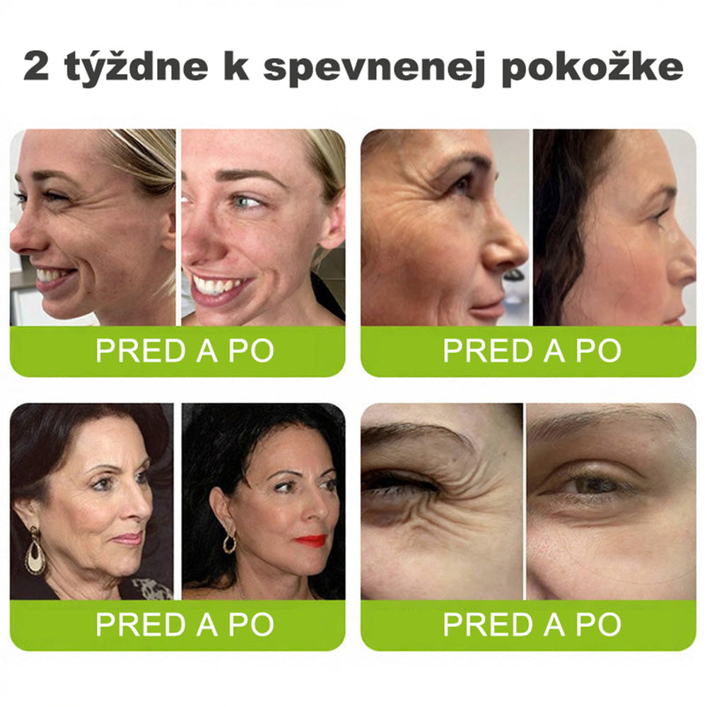 🇸🇰Purelora® Skin Tightening & Vita-A Retinol Retinol🍀 shot Spevňujúci krém proti vráskam - Posledná akcia so 70% zľavou