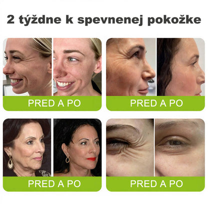 🇸🇰Purelora® Skin Tightening & Vita-A Retinol Retinol🍀 shot Spevňujúci krém proti vráskam - Posledná akcia so 70% zľavou