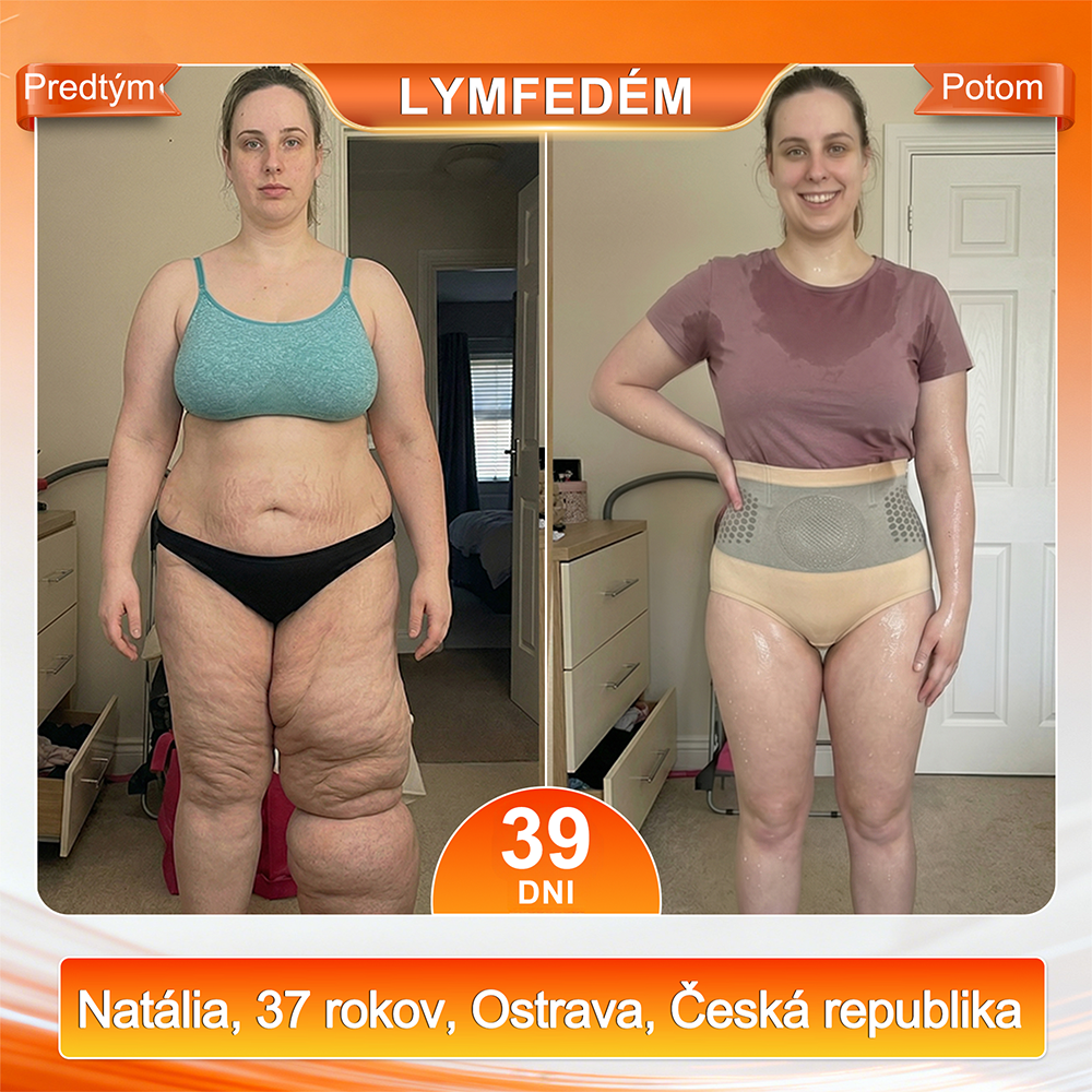 🇸🇰Sfrcord® 4v1 Termogénne Tvarujúce Šortky s Moringou a Berberin 💯 – ⚡ Kompresné Kraťasy pre Tvarovanie Postavy, Podporu Metabolizmu & Denné Nosenie (30 min rutina) 🌸 Časovo obmedzená zľava až 7