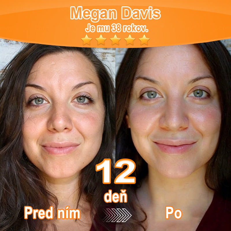 🇸🇰Purelora® Revitalizačný esenciálny krém s kmeňovými💧 bunkovými extraktmi, EGF a meďnatými peptidmi